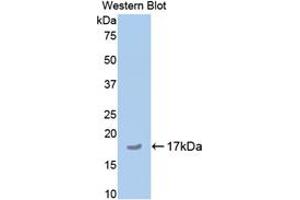 Western blot analysis of the recombinant protein. (COMP anticorps  (AA 35-179))