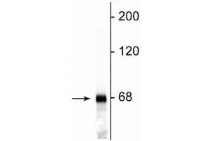 Western blot of rat cortical lysate showing specific immunolabeling of the ~68 kDa NF-L protein. (NEFL anticorps)