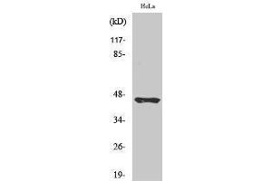 Western Blotting (WB) image for anti-Plasma Kallikrein HC (Arg390), (cleaved) antibody (ABIN3181850) (Plasma Kallikrein HC (Arg390), (cleaved) anticorps)