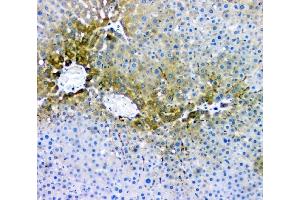 IHC analysis of RMI2 using anti-RMI2 antibody (ABIN6719656). (RMI2 anticorps)