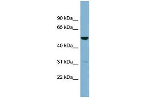 WB Suggested Anti-SDSL Antibody Titration:  0. (SDSL anticorps  (Middle Region))