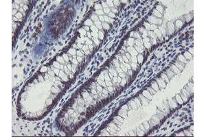 Image no. 1 for anti-SUMO1/sentrin/SMT3 Specific Peptidase 2 (SENP2) (AA 139-523) antibody (ABIN1490931) (SENP2 anticorps  (AA 139-523))