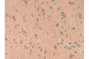 Detection of C1qA in Human Brain Tissue using Polyclonal Antibody to Complement Component 1, Q Subcomponent A (C1qA)