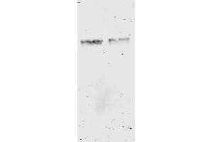 Western Blotting (WB) image for anti-Glutathione S Transferase (GST) antibody (ABIN400782) (GST anticorps)