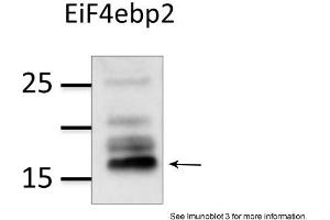 Sample Type: mouse brain extract (50ug)Primary Dilution: 1:1000Image Submitted by: Veronique DorvalLaval University, Canada .