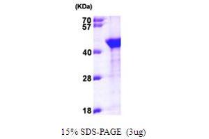 Aminoacyl tRNA Synthetase Complex-Interacting Multifunctional Protein 1 (AIMP1) (AA 1-336) protein (His tag)