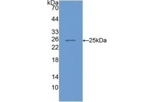 Detection of Recombinant COMP, Mouse using Polyclonal Antibody to Cartilage Oligomeric Matrix Protein (COMP) (COMP anticorps  (AA 554-753))