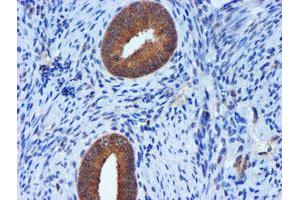 Image no. 2 for anti-Metalloproteinase Inhibitor 2 (TIMP2) antibody (ABIN1501393) (TIMP2 anticorps)