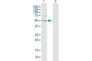 Western Blot analysis of TBL2 expression in transfected 293T cell line by TBL2 MaxPab polyclonal antibody. (TBL2 anticorps  (AA 1-447))