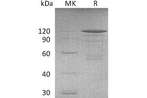 Western Blotting (WB) image for P-Cadherin (CDH3) protein (Fc Tag) (ABIN7320475) (P-Cadherin Protein (CDH3) (Fc Tag))