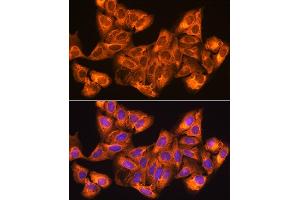 Immunofluorescence analysis of U2OS cells using ZCCHC11 Rabbit pAb (ABIN6128939, ABIN6150406, ABIN6150407 and ABIN6221650) at dilution of 1:100.