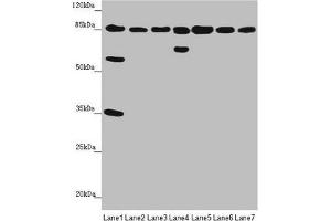 Western blot All lanes: NELL1 antibody at 3. (NELL1 anticorps  (AA 160-420))