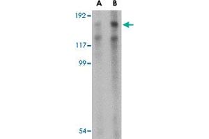 Western blot analysis of TARBP1 in NIH/3T3 cell lysate with TARBP1 polyclonal antibody  at (A) 1 and (B) 2 ug/mL . (TARBP1 anticorps  (Internal Region))