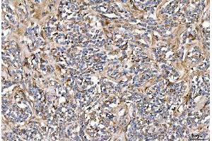 IHC analysis of Alpha 2 Antiplasmin/SERPINF2 using anti-Alpha 2 Antiplasmin/SERPINF2 antibody (ABIN7601808). (alpha 2 Antiplasmin anticorps  (AA 461-491))