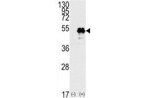 Western blot analysis of TP53 antibody and 293 cell lysate (2 ug/lane) either nontransfected (Lane 1) or transiently transfected with the TP53 gene (2).