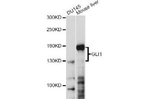 Western blot analysis of extracts of various cell lines, using GLI1 antibody. (GLI1 anticorps)