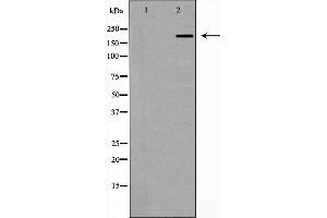 Western blot analysis of ZO 1 expression in Human brain,The lane on the left is treated with the antigen-specific peptide. (TJP1 anticorps)