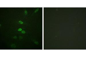 Peptide - +Immunofluorescence analysis of HeLa cells, using CDC25B (Ab-353) antibody. (CDC25B anticorps  (Ser353))