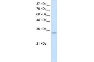 WB Suggested Anti-PRKRA Antibody Titration:  0.