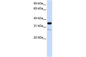 WB Suggested Anti-TMEM38A Antibody Titration:  0. (TMEM38A anticorps  (N-Term))