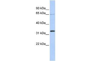 WB Suggested Anti-GRHL2 Antibody Titration:  1 ug/ml  Positive Control:  721_B cell lysate (GRHL2 anticorps  (Middle Region))