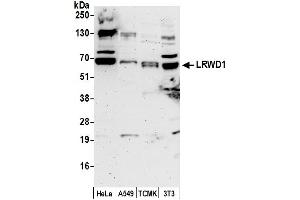 anti-Leucine-Rich Repeat and WD Repeat-Containing Protein 1 (LRWD1) (AA 432-482) antibody