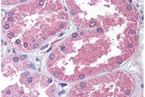 Human Kidney (formalin-fixed, paraffin-embedded) stained with AADAT antibody ABIN239800 at 2. (AADAT anticorps  (N-Term))