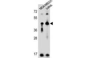 Western Blotting (WB) image for anti-Killer Cell Immunoglobulin-Like Receptor, Two Domains, Long Cytoplasmic Tail, 2 (KIR2DL2) antibody (ABIN3002433)