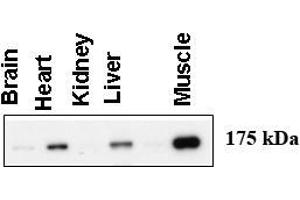 Western blot using anti-AGL antibody at 1:1000 dilution. (AGL anticorps  (C-Term))