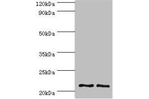 Western blot All lanes: DNAL1 antibody at 4 μg/mL Lane 1: Hela whole cell lysate Lane 2: HepG2 whole cell lysate Secondary Goat polyclonal to rabbit IgG at 1/10000 dilution Predicted band size: 22, 9, 18 kDa Observed band size: 22 kDa (DNAL1 anticorps  (AA 41-190))