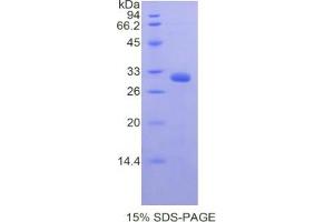 SDS-PAGE analysis of Mouse Myosin IA Protein.