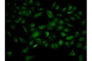 Immunofluorescence analysis of HeLa cell using YWHAB antibody. (YWHAB anticorps  (AA 1-246))