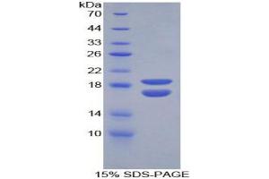 SDS-PAGE analysis of Mouse PHPT1 Protein.