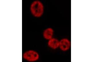 ABIN6276970 staining HepG2? (POLI anticorps  (N-Term))