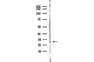 anti-Interleukin 28B (Interferon, lambda 3) (IL28B) antibody