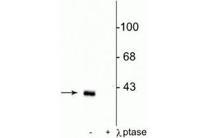Western blot of rat striatal lysate showing specific immunolabeling of the ~32 kDa DARPP-32 phosphorylated at Thr75 in the first lane (-). (DARPP32 anticorps  (pThr75))