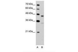 Image no. 2 for anti-G Protein-Coupled Receptor 161 (GPR161) (C-Term) antibody (ABIN203448) (GPR161 anticorps  (C-Term))