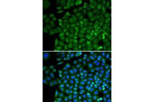 Immunofluorescence analysis of HeLa cells using SELENBP1 antibody (ABIN3021766, ABIN3021767, ABIN3021768 and ABIN1513508). (SELENBP1 anticorps  (AA 243-472))