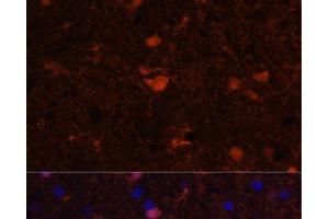 Immunofluorescence analysis of Rat brain using S100B Polyclonal Antibody at dilution of 1:100. (S100B anticorps)