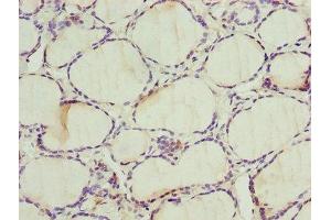 Immunohistochemistry of paraffin-embedded human thyroid tissue using ABIN7142596 at dilution of 1:100 (ALAS2 anticorps  (AA 50-587))