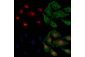 ABIN6258128 and ABIN6275417 staining  cells by IF/ICC. (DYRK3 anticorps  (C-Term))