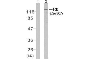 Western blot analysis of extracts from K562 cells untreated or treated with 10% serum after 48 hours of starvation, using Rb (phospho-Ser807) antibody (E011131). (Retinoblastoma 1 anticorps  (pSer807))