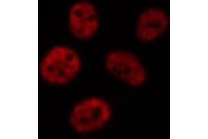 ABIN6277127 staining 293 by IF/ICC. (CHEK2 anticorps  (Internal Region))