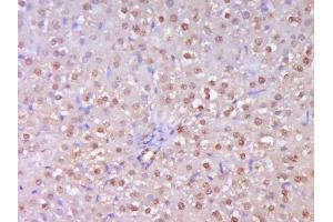 Paraformaldehyde-fixed, paraffin embedded Rat Liver Antigen retrieval by boiling in sodium citrate buffer (pH6. (TERT anticorps  (AA 601-750))