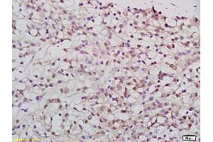 Formalin-fixed and paraffin embedded rat brain tissue labeled with Anti-PATZ1 Polyclonal Antibody, Unconjugated (ABIN759836) at 1:200 followed by conjugation to the secondary antibody and DAB staining (PATZ1 anticorps  (AA 351-450))