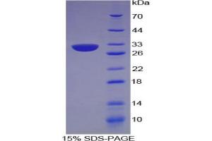 SDS-PAGE analysis of Human Centromere Protein I Protein. (CENPI Protéine)