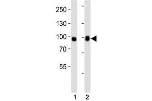 Western blot analysis of lysate from (1) A549 and (2) HeLa cell line using FGFR3 antibody at 1:1000.