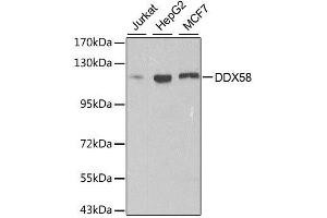 Western blot analysis of extracts of various cell lines, using DDX58 antibody. (DDX58 anticorps  (C-Term))