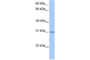 HAGH antibody used at 1 ug/ml to detect target protein. (HAGH anticorps  (C-Term))