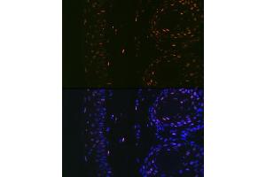 Immunofluorescence analysis of Rat tail and ear using MITF Rabbit mAb (ABIN7268511) at dilution of 1:100 (40x lens).